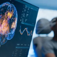 Study suggests yawning may help move cerebrospinal fluid and venous blood out of the skull, potentially playing a role in cleaning brain fluid