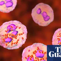 Experts consider expanding meningitis vaccine eligibility after Kent outbreak