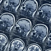 Brain scans of 800 incarcerated men link psychopathy to an expanded cortical surface area