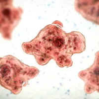 Brain-eating amoeba detected in western national park waters