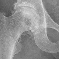 STAT+: Can you spot a deepfake X-ray? Neither can your radiologist