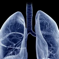 STAT+: Insmed drug benefits patients with rare, bacterial lung disease, study shows